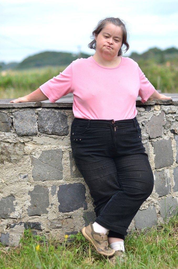 唐氏综合征的女人