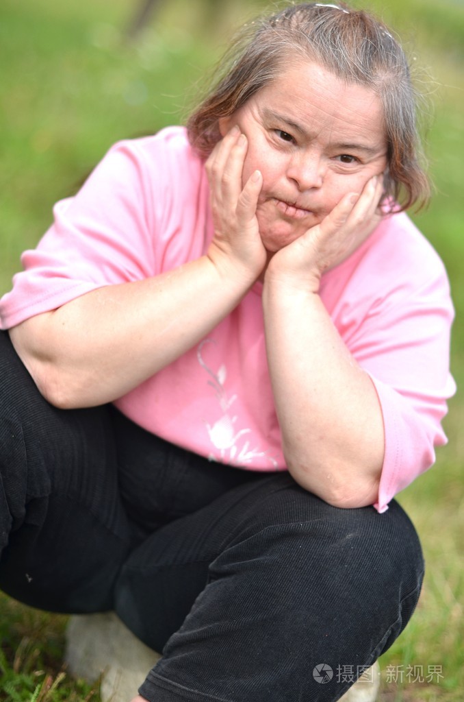 唐氏综合征的女人照片-正版商用图片19v3vs-摄图新视界