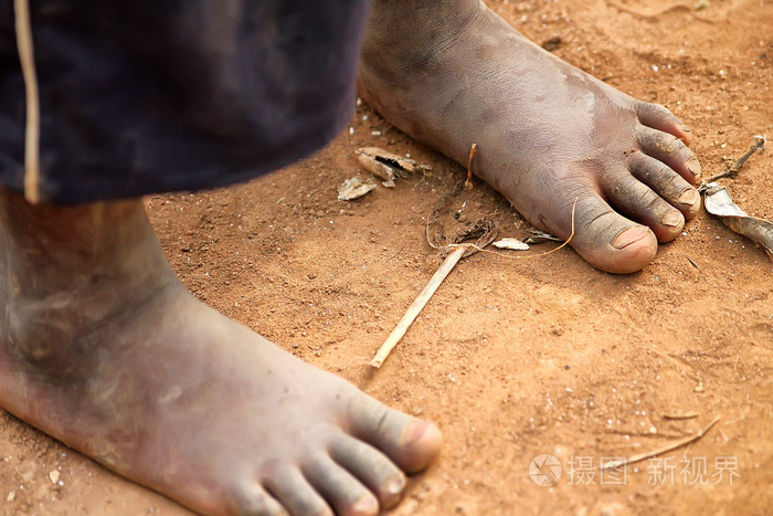 非洲儿童的脚