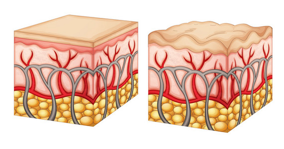 橘皮组织橘皮组织按摩检查上她臀部的橘皮组织的女人