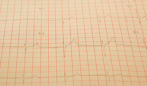 心电图磁带图图片