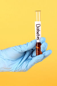 标签为糖尿病的手放在黄色背景上的测试管