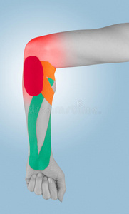 手肘疼痛疼痛和紧张的物理治疗