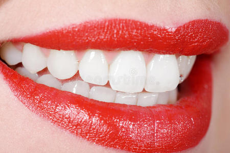 健康的女性牙齿和牙医的口腔镜女性牙齿美白前后.