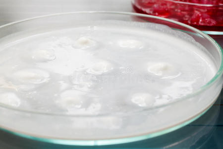 培养皿中的细菌
