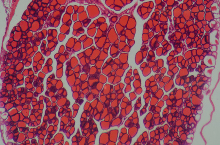 科学医学人体解剖学生理学微观人类 thyroi