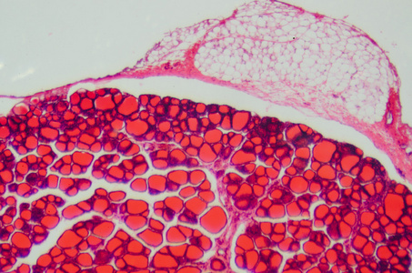 科学医学人体解剖学生理学微观人类 thyroi