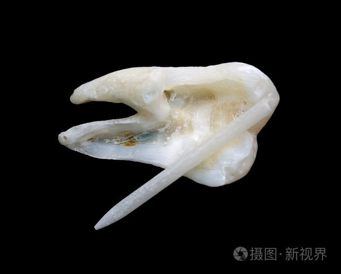 从人类牙齿的截面视图