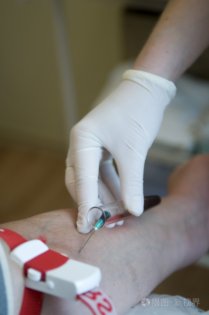 静脉的采血