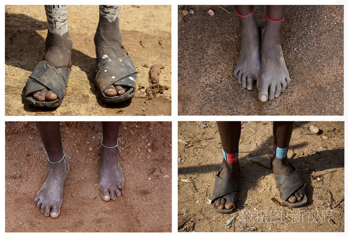 埃塞俄比亚妇女的脚型