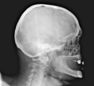 颈部和头部的 x 射线图像的细节