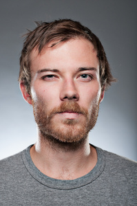 白种男人与斜视眼盯着下照片