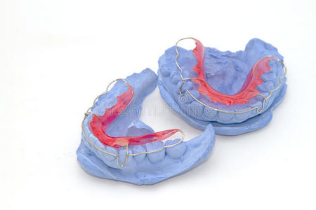 牙科石膏模型和牙科支架固位器