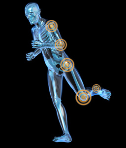 x 射线与疼痛的腿和胳膊见运行男人的侧视图