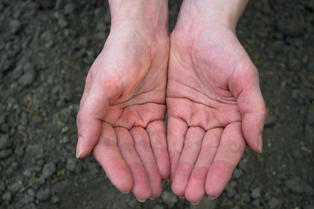 干裂的手图片