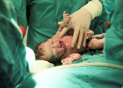 初生婴儿在劳动室图片