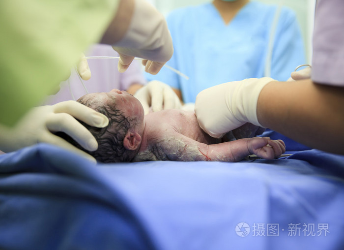 初生婴儿在劳动室照片-正版商用图片1cfgy4-摄图新视界