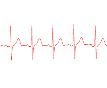 在白色背景上的心电图