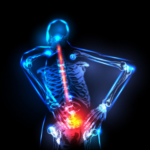 x 射线，背部疼痛，很容易在人类骨干可编辑