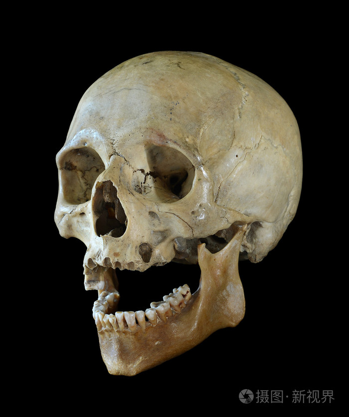 人类头骨