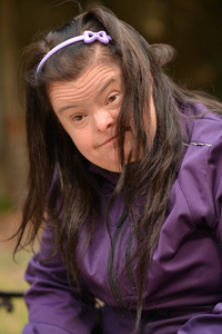 唐氏综合征的孩子图片