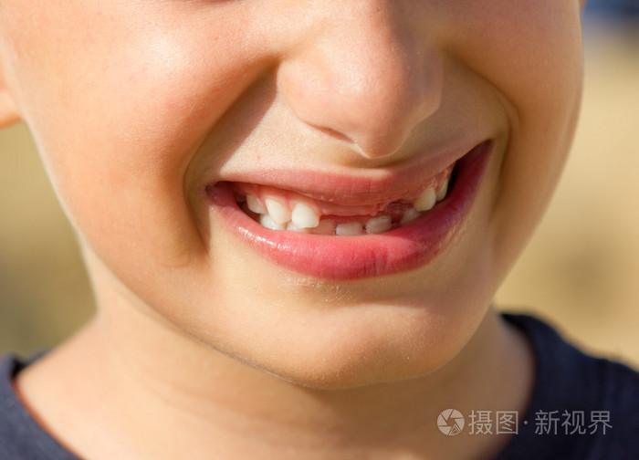 孩子没了牙的微笑