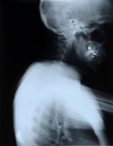 颈部和头部的 x 射线图像的细节