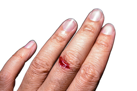 手指血图片