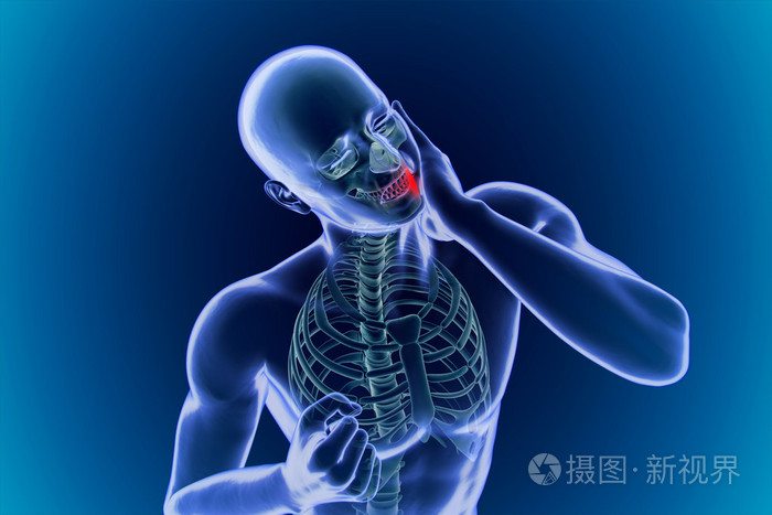 牙痛下巴疼痛照片 正版商用图片1dv7e0 摄图新视界 牙痛下巴疼痛照片 正版商用图片1dv7e0 摄图新视界