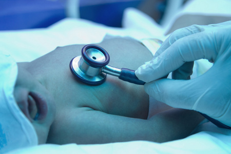 医生用听诊器考试早产的婴儿