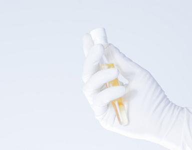 玻璃管与医疗测试期间的科学家手中的黄色液体的特写镜头