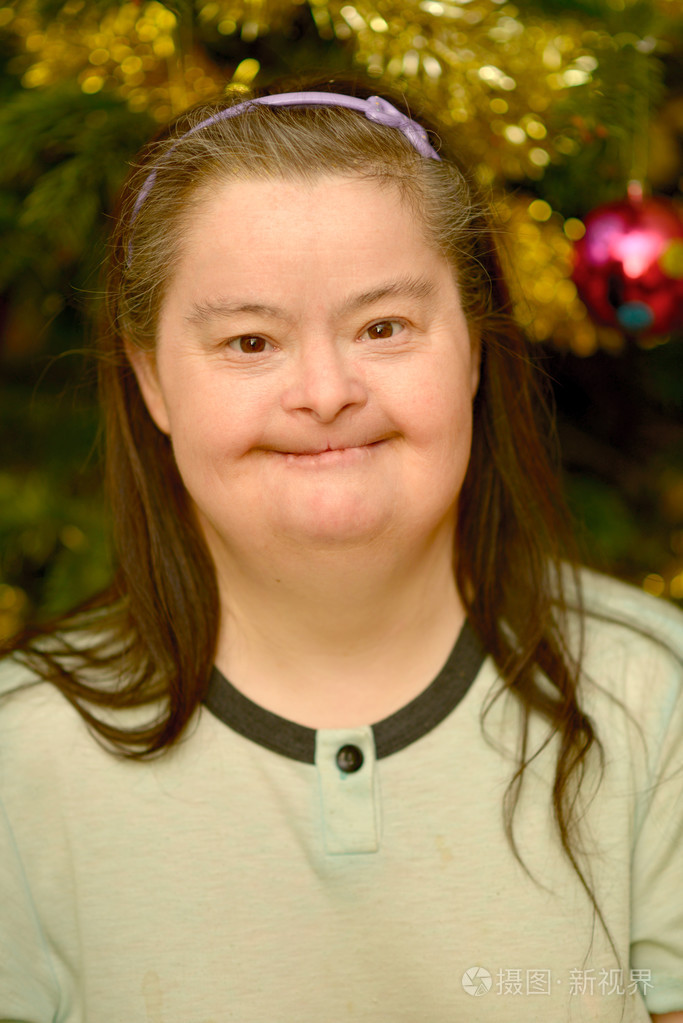 唐氏综合征的女人