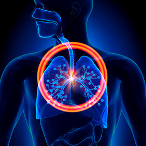 肺部异物吸入或吞咽