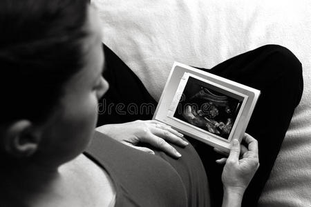 怀孕孕妇看超声波扫描