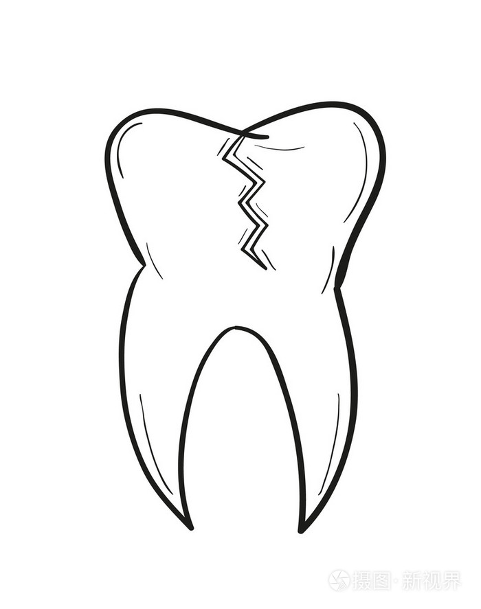 草绘的齿形与缺陷插画-正版商用图片1ezoun-摄图新视界