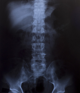 人类胸部医用诊断 x 射线图像
