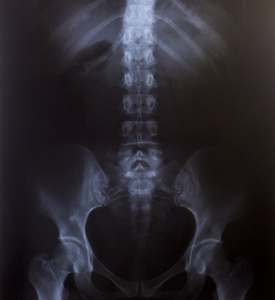 人类胸部医用诊断 x 射线图像