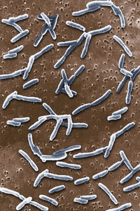 在电子显微镜下的好氧照片