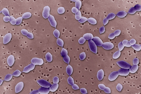 在电子显微镜下的厌氧菌照片