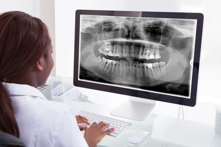 女牙医检查计算机在临床上的颌骨 x 射线