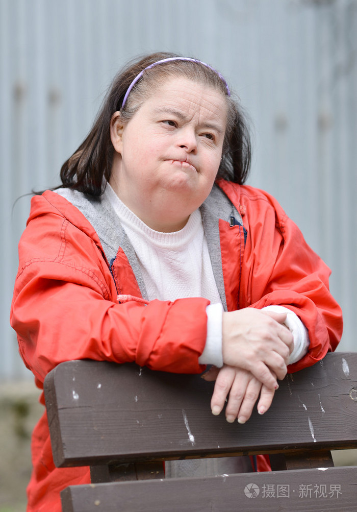 唐氏综合征的女人