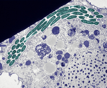 梨状肌四膜虫照片
