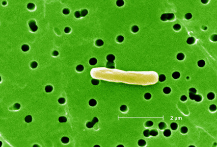 大肠埃希氏大肠杆菌细菌