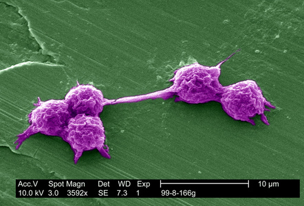 变形虫吞噬hartmannella 蚓囊肿照片