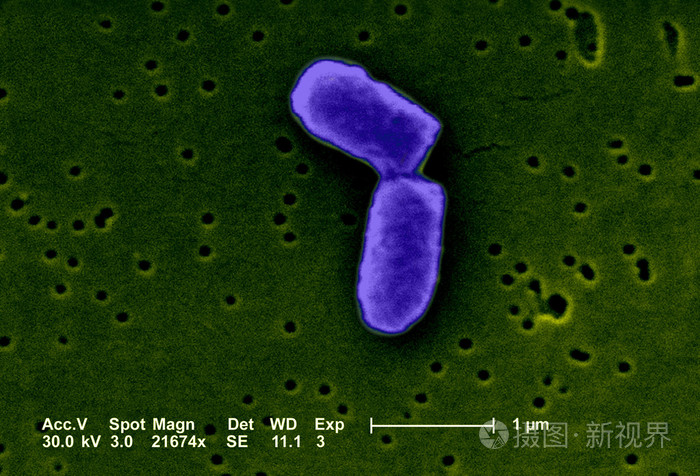 在显微镜下的大肠埃希氏大肠杆菌