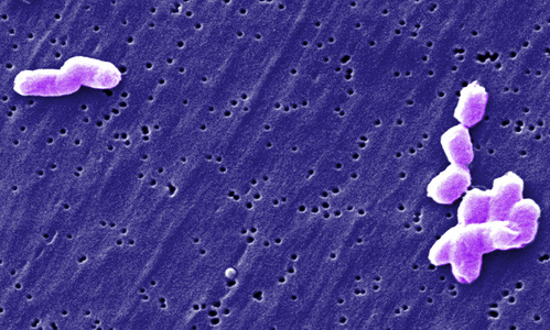 Salmonella under Mikroskop在显微镜下的沙门氏菌