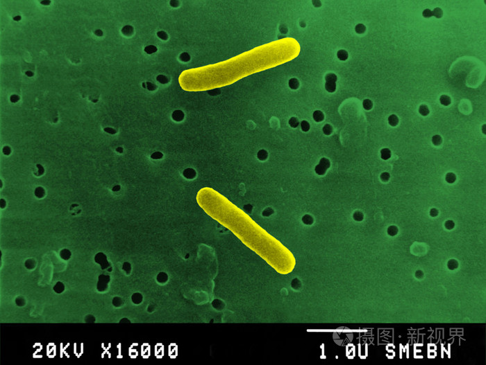 沙门氏菌图片显微镜图片