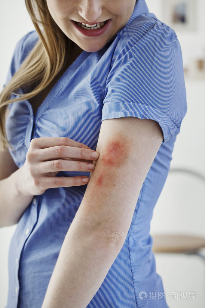 一个女人在瘙痒