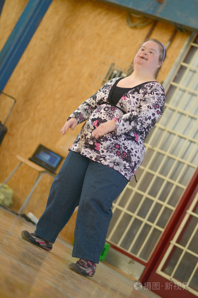 唐氏综合征的女人