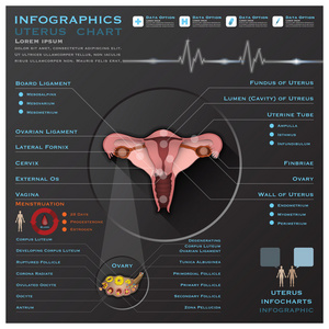 子宫和卵巢解剖系统医疗信息图表 infochart